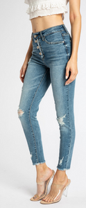 Mid Button Fly Distressed Cropped Kancan Jeans